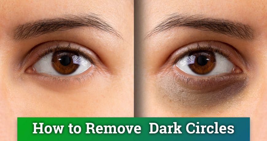 how-remove-dark-circles- afro-glamour-cosmetics